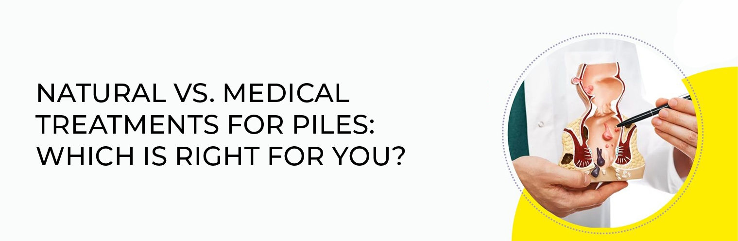 Natural vs. Medical Treatments for Piles: Which is Right for You?