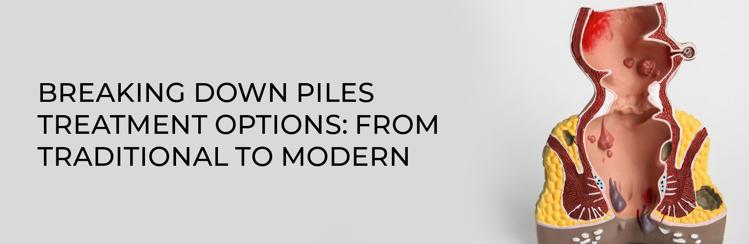 Breaking Down Piles Treatment Options: From Traditional to Modern