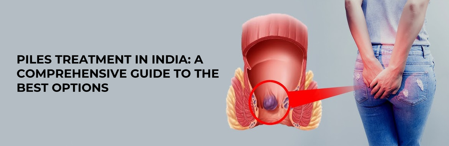 Piles Treatment in India: A Comprehensive Guide to the Best Options